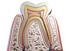 進行した虫歯でも歯を残す治療――根管治療